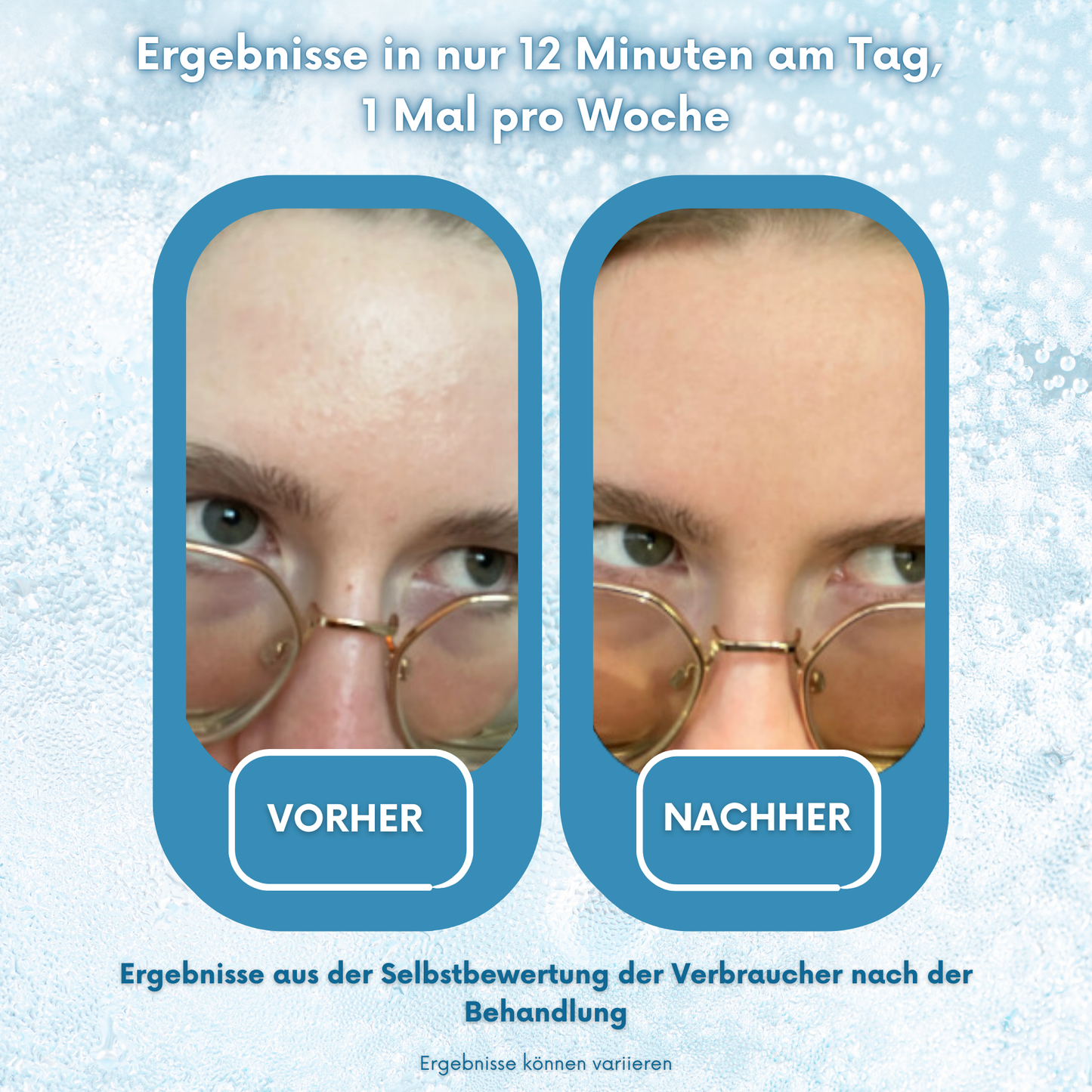 PoreX Original – Deine Haut, nur besser
